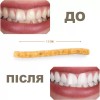 Мисвак (сівак) Sewak Al-Kureysh Gold паличка для чищення зубів 15 см Стандарт